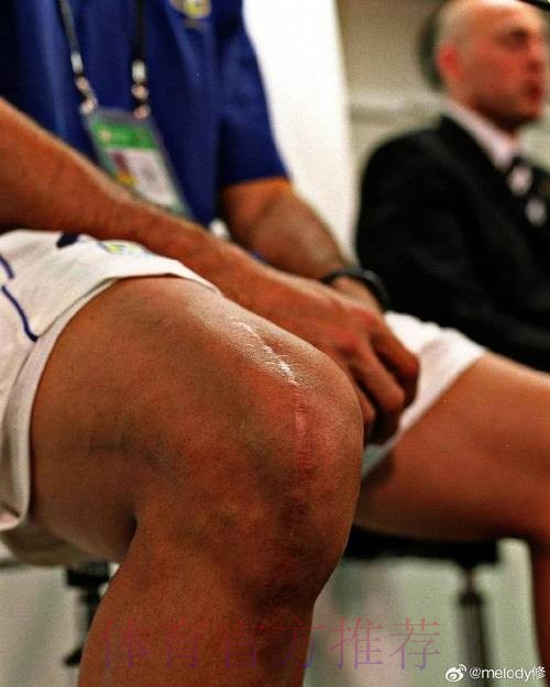 皇马官方:罗德里戈右腿股二头肌肌腱受伤 皇马官方:罗德里戈右腿股二头肌肌腱受伤